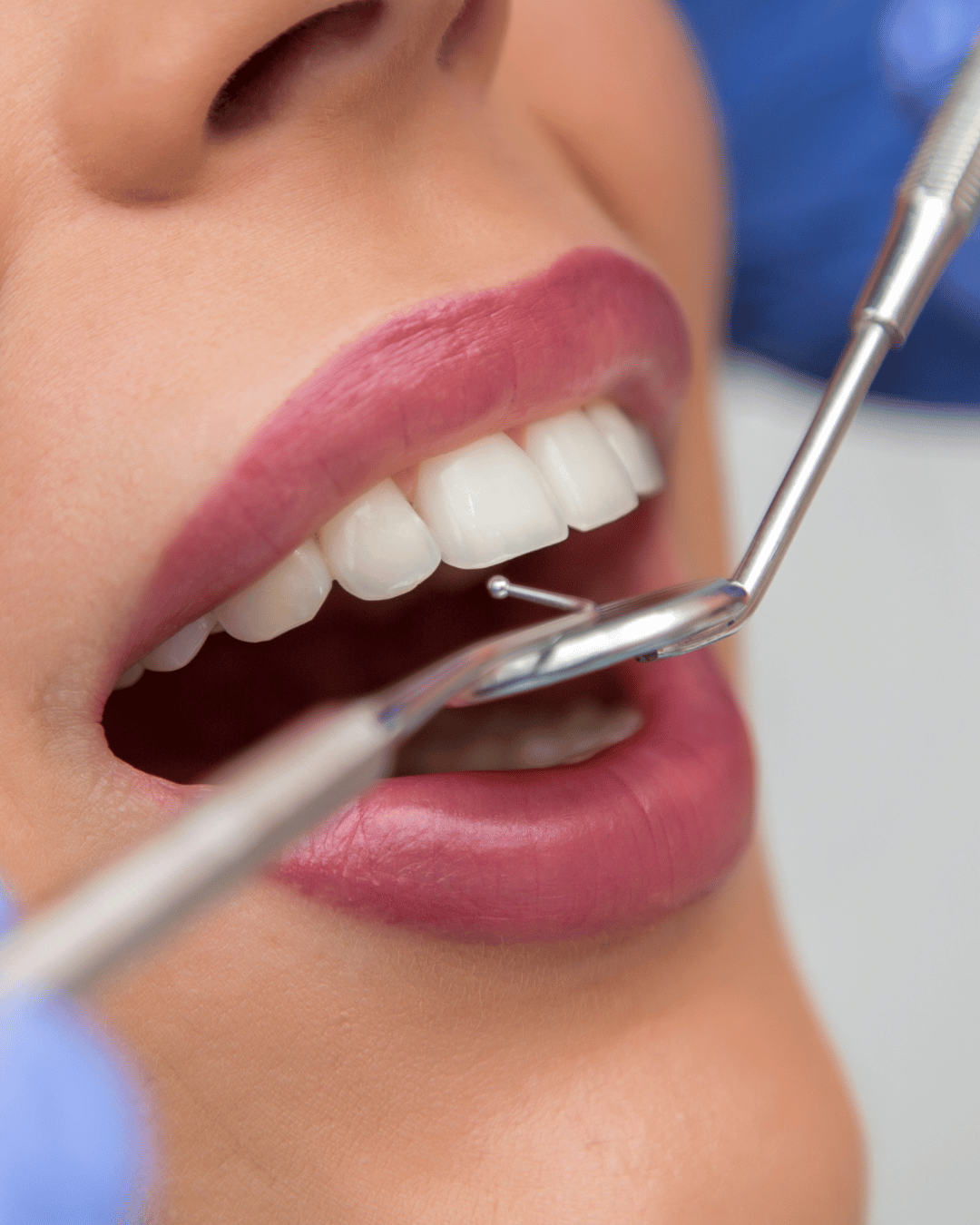 Soins Dentaires – Lama Para & Centre d’Esthétique